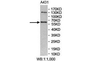 Western Blotting (WB) image for anti-Makorin Ring Finger Protein 3 (MKRN3) antibody (ABIN1855943) (MKRN3 抗体)