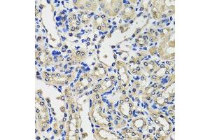 Immunohistochemistry of paraffin-embedded mouse kidney using SCG3 antibody. (SCG3 抗体  (AA 199-468))