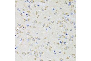 Immunohistochemistry of paraffin-embedded rat brain using YWHAZ antibody. (14-3-3 zeta 抗体  (AA 1-100))