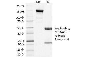 SDS-PAGE Analysis of Purified Clathrin, LC Mouse Monoclonal Antibody (CLC/1421). (CLTA/CLTB 抗体  (N-Term))