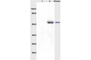 Lane 1: rat brain lysates Lane 2: human colon carcinoma lysates probed with Anti AVPR2 Polyclonal Antibody, Unconjugated (ABIN731468) at 1:200 in 4 °C. (MCTS1 抗体  (C-Term))