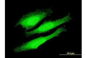 Immunofluorescence of purified MaxPab antibody to KIAA1967 on HeLa cell. (CCAR2 抗体  (AA 1-923))