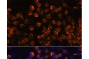 Immunofluorescence (IF) image for anti-Complement Factor B (CFB) antibody (ABIN7259542)