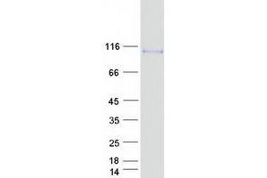Western Blotting (WB) image for Ataxin 1 (ATXN1) (Transcript Variant 2) protein (Myc-DYKDDDDK Tag) (ABIN2715013)
