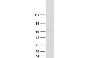 Western Blotting (WB) image for Leucine Rich Repeat Containing 2 (LRRC2) (Transcript Variant 1) protein (Myc-DYKDDDDK Tag) (ABIN2724898)