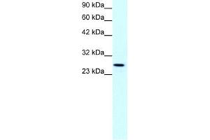 Human Jurkat; WB Suggested Anti-CLDN13 Antibody Titration: 1. (Claudin 13 (CLDN13) (C-Term) 抗体)
