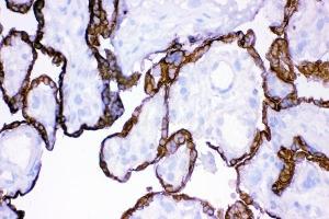IHC analysis of HSD11B2 using anti-HSD11B2 antibody (ABIN3043846).
