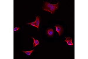 ABIN6258094 and ABIN6274318 staining Hela by IF/ICC.