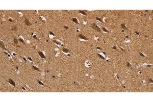 Immunohistochemistry (Paraffin-embedded Sections) (IHC (p)) image for anti-NADH Dehydrogenase (Ubiquinone) Fe-S Protein 1, 75kDa (NADH-Coenzyme Q Reductase) (NDUFS1) antibody (ABIN7237504)