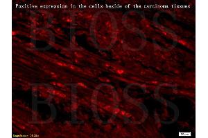 Immunofluorescence (IF) image for anti-Solute Carrier Family 25 (Mitochondrial Carrier, Dicarboxylate Transporter), Member 10 (SLC25A10) (AA 201-287) antibody (ABIN752293)