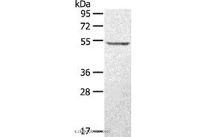 Western blot analysis of A431 cell, using STYK1 Polyclonal Antibody at dilution of 1:500 (STYK1 抗体)