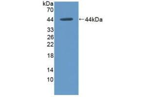 Western blot analysis of recombinant Rat HK1.