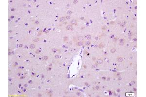 Formalin-fixed and paraffin embedded rat brain labeled with Rabbit Anti LGI1/ETL1 Polyclonal Antibody, Unconjugated (ABIN720430) at 1:200 followed by conjugation to the secondary antibody and DAB staining (LGI1 抗体  (AA 451-557))