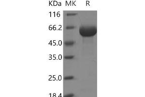 Western Blotting (WB) image for Receptor Tyrosine Kinase-Like Orphan Receptor 1 (ROR1) protein (His tag,ECD) (ABIN7197643) (ROR1 Protein (His tag,ECD))