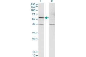 Western Blot analysis of DFNA5 expression in transfected 293T cell line by DFNA5 monoclonal antibody (M01), clone 1E10. (DFNA5 抗体  (AA 111-200))