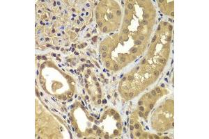 Immunohistochemistry of paraffin-embedded human kidney using SORT1 antibody. (Sortilin 1 抗体  (AA 520-760))