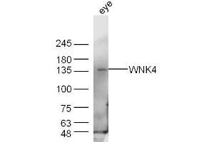 Mouse eye lysates probed with WNK4 Polyclonal Antibody, Unconjugated  at 1:300 dilution and 4˚C overnight incubation. (WNK4 抗体  (AA 351-450))