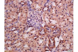 Formalin-fixed and paraffin embedded rat kidney labeled with Rabbit Anti-ATG9A(Ser735) Polyclonal Antibody, Unconjugated (ABIN756307) at 1:200 followed by conjugation to the secondary antibody and DAB staining (ATG9A 抗体  (pSer735))