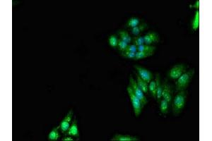 Immunofluorescent analysis of HepG2 cells using ABIN7151204 at dilution of 1:100 and Alexa Fluor 488-congugated AffiniPure Goat Anti-Rabbit IgG(H+L) (RNF6 抗体  (AA 1-298))