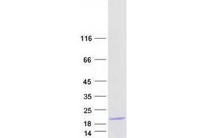 Western Blotting (WB) image for MEF2B Neighbor (MEF2BNB) (Transcript Variant 1) protein (Myc-DYKDDDDK Tag) (ABIN2723187)