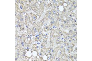 Immunohistochemistry of paraffin-embedded human liver injury using MUC16 antibody (ABIN6003713) at dilution of 1/100 (40x lens). (MUC16 抗体)