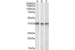 ABIN571286 (1µg/ml) staining of K562 (A), MCF7 (B) and Mouse Liver (C) lysates (35µg protein in RIPA buffer). (POLDIP2 抗体  (Internal Region))