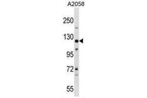 BAT3 Antibody (C-term) western blot analysis in A2058 cell line lysates (35µg/lane). (BAT3 抗体  (C-Term))