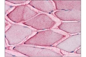 Human Skeletal Muscle: Formalin-Fixed, Paraffin-Embedded (FFPE) (SLC1A5 抗体  (Internal Region))