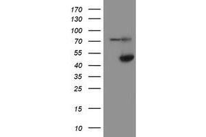 Western Blotting (WB) image for anti-Alcohol Dehydrogenase 7 (Class IV), mu Or sigma Polypeptide (ADH7) antibody (ABIN1496481) (ADH7 抗体)