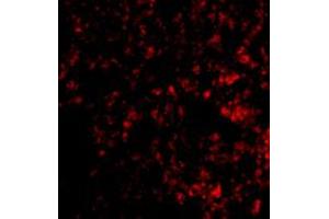 Immunofluorescence of PRDM1 in mouse lung tissue with PRDM1 polyclonal antibody  at 20 ug/mL . (PRDM1 抗体  (C-Term))