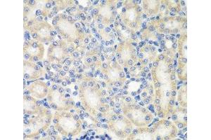 Immunohistochemistry of paraffin-embedded Rat kidney using NAA50 Polyclonal Antibody at dilution of 1:200 (40x lens). (NAA50 抗体)