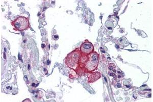 Immunohistochemistry (Formalin-fixed Paraffin-embedded Sections) (IHC (fp)) image for anti-Transient Receptor Potential Cation Channel, Subfamily V, Member 2 (TRPV2) (AA 595-764) antibody (ABIN574136)