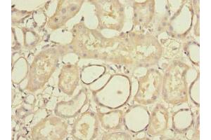 Immunohistochemistry of paraffin-embedded human kidney tissue using ABIN7168993 at dilution of 1:100 (STK33 抗体  (AA 231-514))