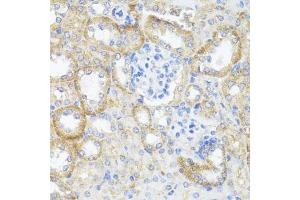 Immunohistochemistry (IHC) image for anti-Argininosuccinate Lyase (ASL) (AA 1-300) antibody (ABIN6137201)