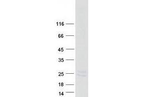 Western Blotting (WB) image for Peripheral Myelin Protein 22 (PMP22) (Transcript Variant 3) protein (Myc-DYKDDDDK Tag) (ABIN2729217)