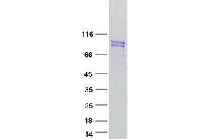 Western Blotting (WB) image for Sad1 and UNC84 Domain Containing 2 (SUN2) protein (Myc-DYKDDDDK Tag) (ABIN2732986)