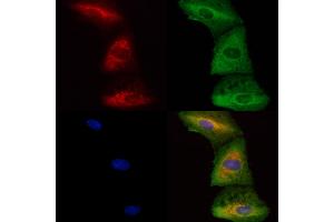 ABIN6262986 and ABIN6278409 staining  cells by IF/ICC.