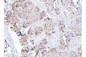 IHC analysis of EIF4G1 using anti-EIF4G1 antibody (ABIN7601860).
