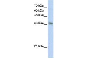 Western Blotting (WB) image for anti-Phytanoyl-CoA 2-Hydroxylase Interacting Protein (PHYHIP) antibody (ABIN2460831) (PHYHIP 抗体)