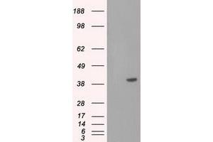 Image no. 2 for anti-Basigin (Ok Blood Group) (BSG) antibody (ABIN1498021) (CD147 抗体)