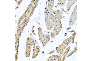 Immunohistochemistry of paraffin-embedded human esophageal smooth muscle using MRPL12 antibody (ABIN5974554) at dilution of 1/100 (40x lens). (MRPL12 抗体)