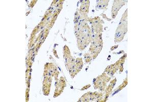 Immunohistochemistry of paraffin-embedded human esophageal smooth muscle using MRPL12 antibody (ABIN5974554) at dilution of 1/100 (40x lens). (MRPL12 抗体)