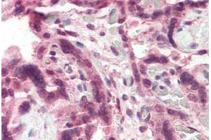 Human Placenta (formalin-fixed, paraffin-embedded) stained with CCKBR antibody ABIN337053 at 5 ug/ml followed by biotinylated anti-goat IgG secondary antibody ABIN481715, alkaline phosphatase-streptavidin and chromogen. (CCKBR 抗体  (AA 251-266))