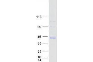 Western Blotting (WB) image for Forkhead Box B1 (FOXB1) protein (Myc-DYKDDDDK Tag) (ABIN2721341)
