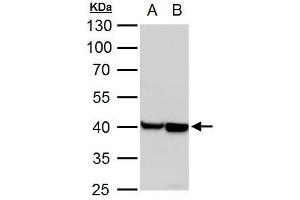 WB Image alpha Actin (cardiac muscle) antibody detects alpha Actin (cardiac muscle) protein by western blot analysis. (ACTC1 抗体)