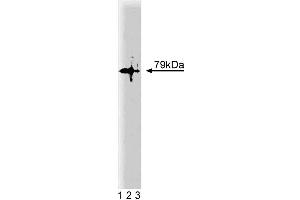 Western blot analysis of PKCtheta on a Jurkat lysate. (PKC theta 抗体  (AA 21-217))