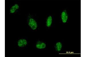 Immunofluorescence of purified MaxPab antibody to MTMR8 on HepG2 cell. (MTMR8 抗体  (AA 1-704))