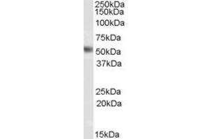 Western Blotting (WB) image for anti-ArfGAP with GTPase Domain, Ankyrin Repeat and PH Domain 1 (AGAP1) (Middle Region) antibody (ABIN2788993)