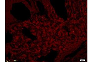 Formalin-fixed and paraffin embedded rat skin tissue labeled with Rabbit Anti-CD272/BTLA Polyclonal Antibody (ABIN671031), Unconjugated at 1:200 followed by conjugation to the secondary antibody and DAB staining. (BTLA 抗体  (AA 221-289))