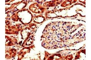 Immunohistochemistry of paraffin-embedded human kidney tissue using ABIN7143637 at dilution of 1:100 (AKR1A1 抗体  (AA 2-325))